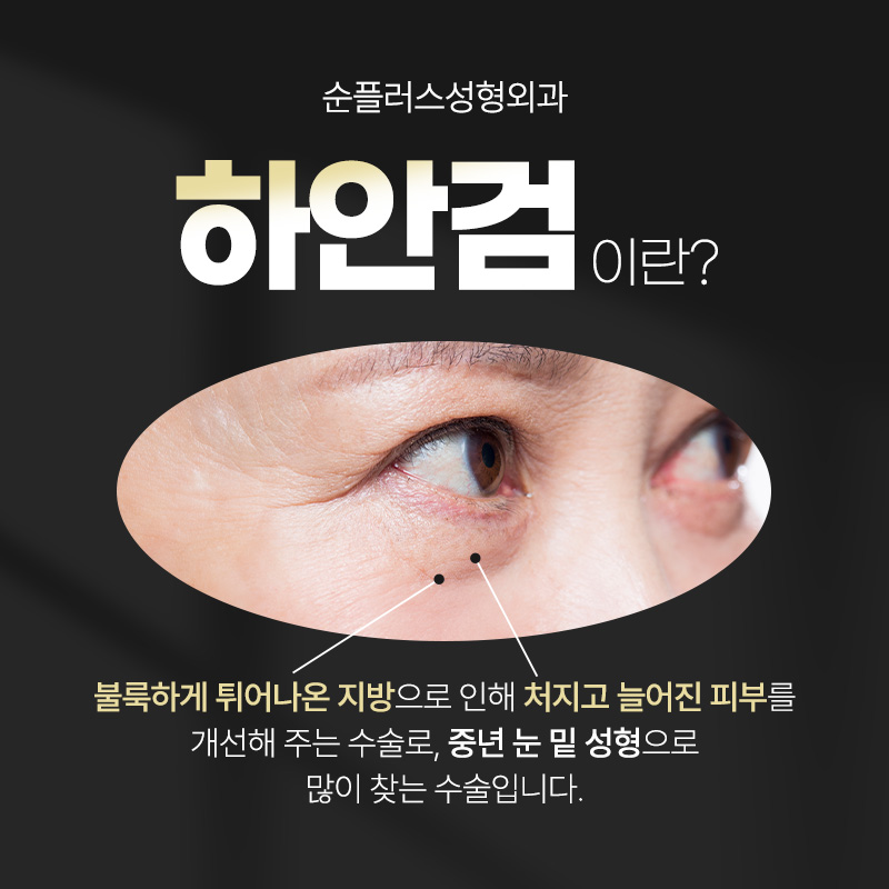 하안검수술 회복기간 흉터 나아지는 시기 관련 이미지 2