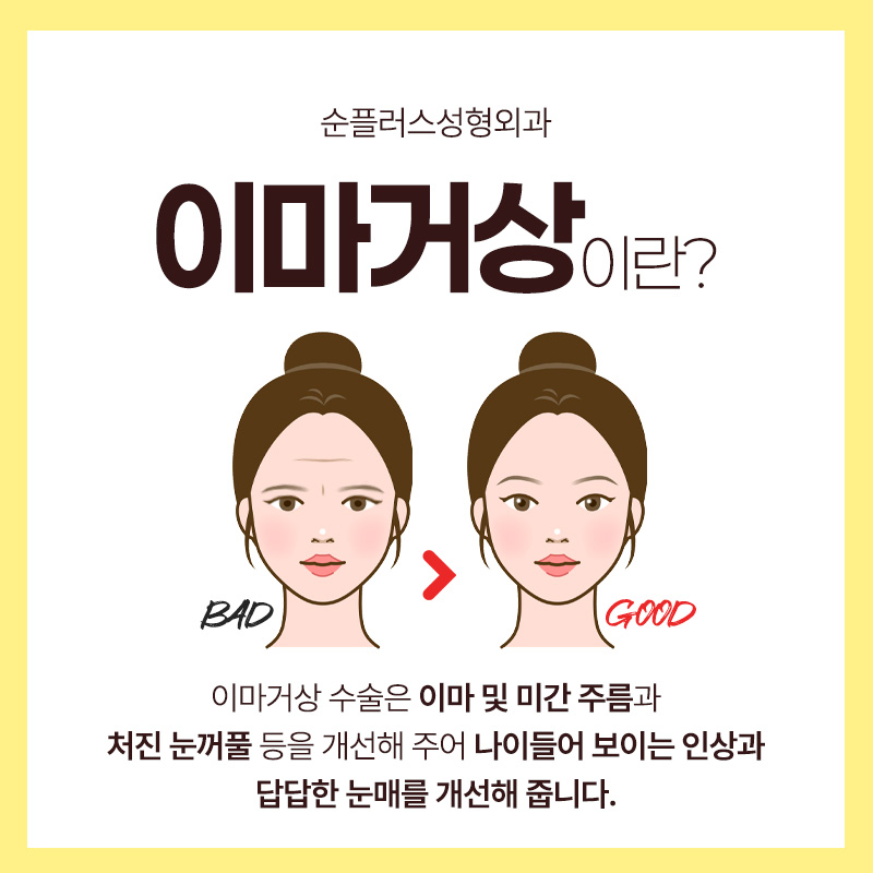 이마,눈매,인상 개선까지 이마거상술의 다양한 효과 관련 이미지 2