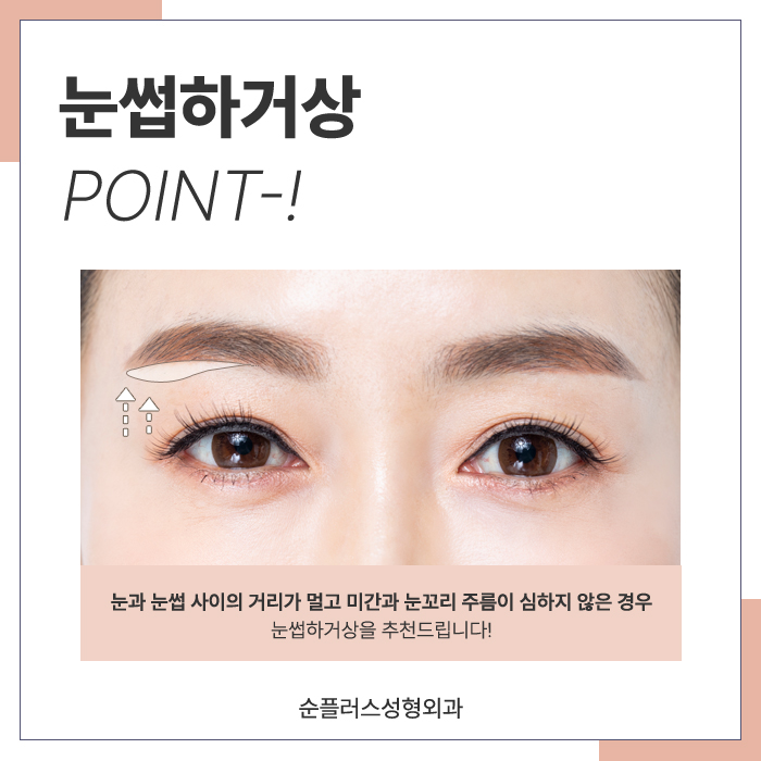 For Eye Shape Changes Through Midlife Eyelid Drooping Surgery image 3