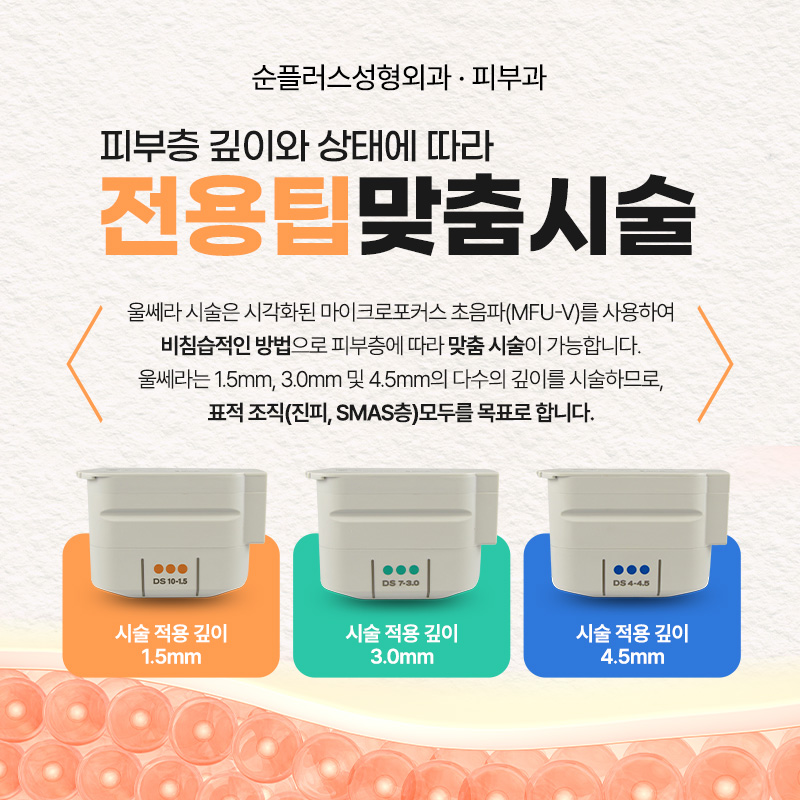 팔자주름, 울쎄라 레이저로 리프팅해 볼륨과 탄력 효과를 관련 이미지 6