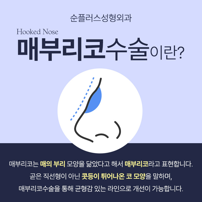 매부리코성형 굴곡짐을 개선해 관련 이미지 2