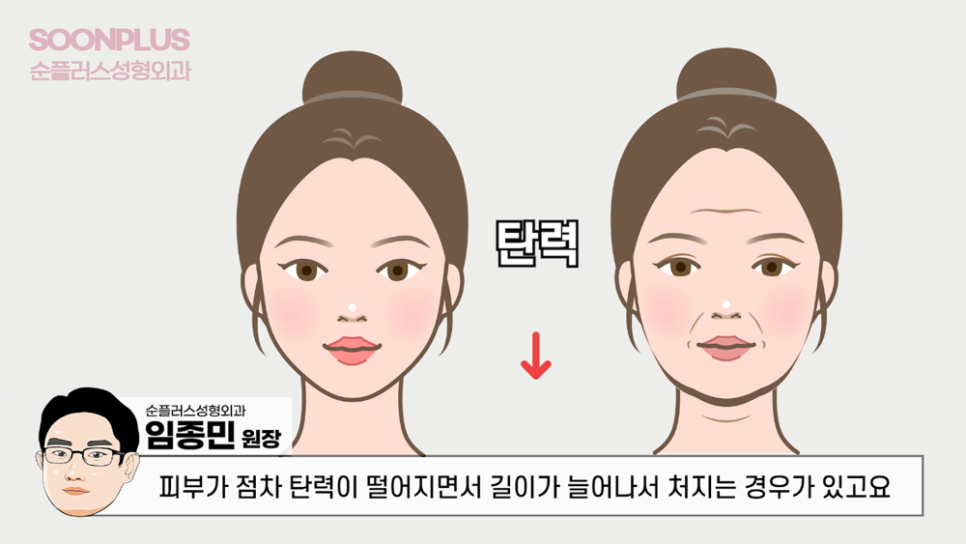 안면윤곽 후 (볼/살)처짐 어떻게 해야 개선될까 관련 이미지 2