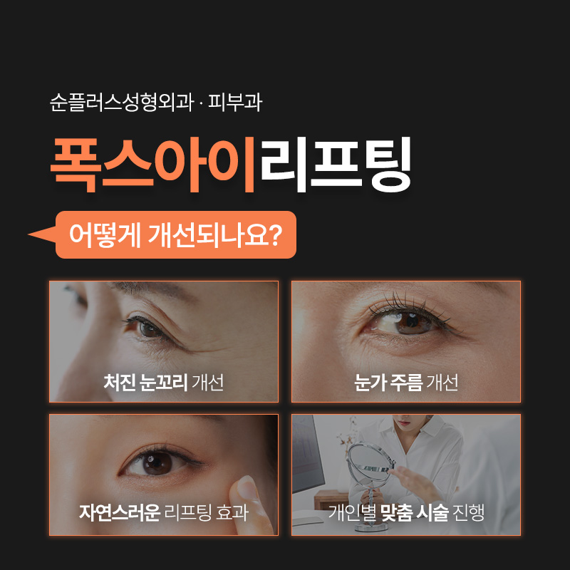 Naturally Improving a Drooping Outer Eye Corner: Outer Eye Corner Thread Lifting image 3