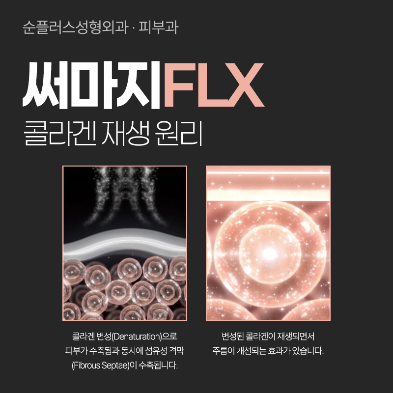 신사 고주파리프팅 써마지, 어떤 피부타입이 적합할까? 추천대상부터 특징 효과까지 관련 이미지 3