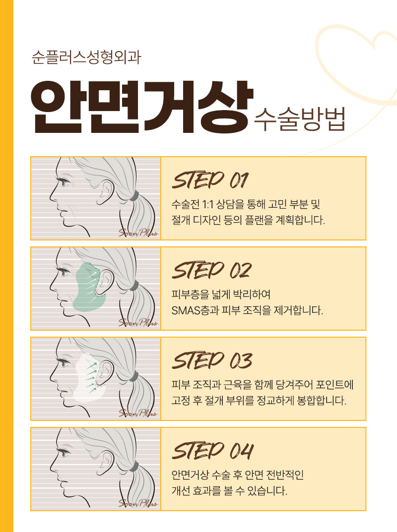 A Place Known for Good Facelift Surgery While Reducing Scarring image 3