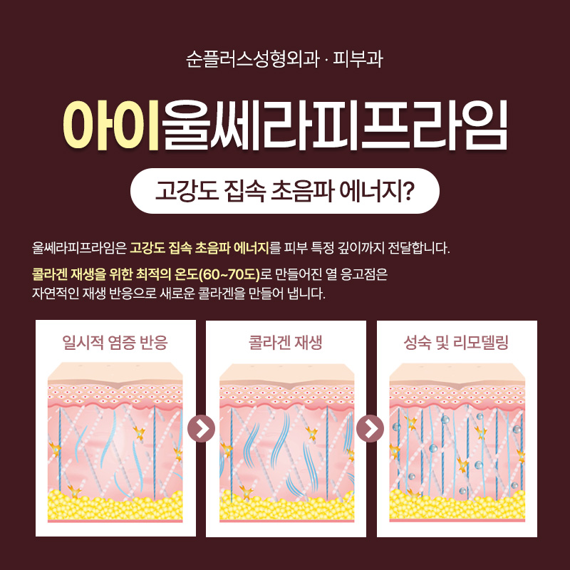 아이 울쎄라피프라임 효과, 울쎄라피프라임 정품확인 방법 관련 이미지 3