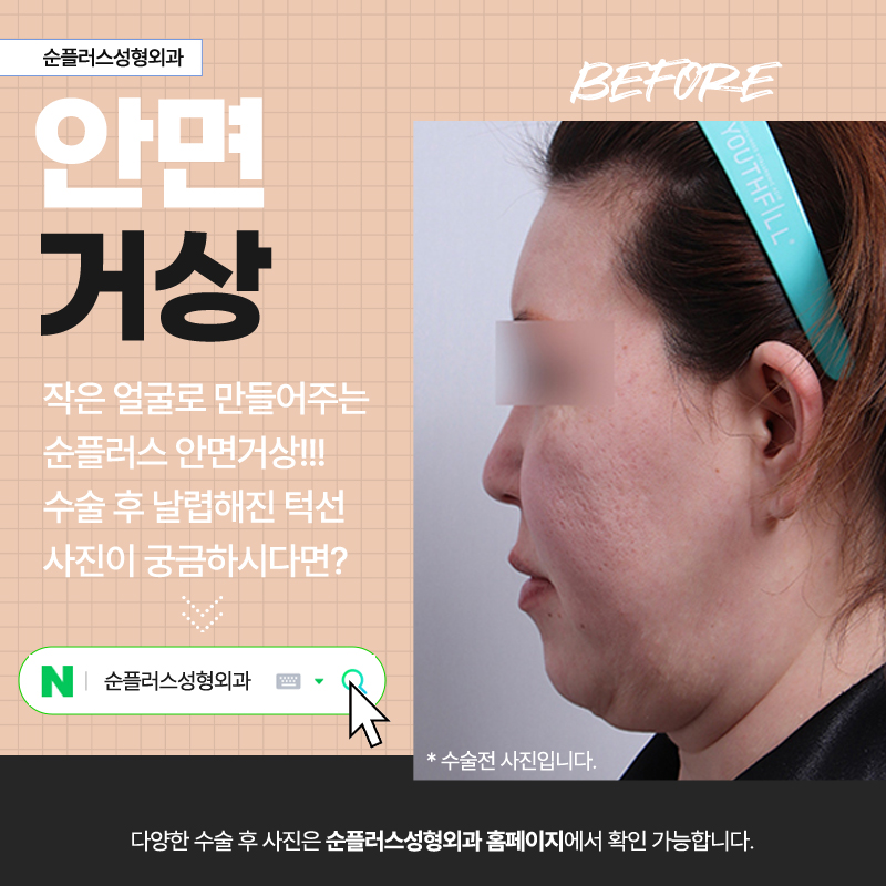 If You’re Having Difficulty Choosing a Facelift Hospital image 5