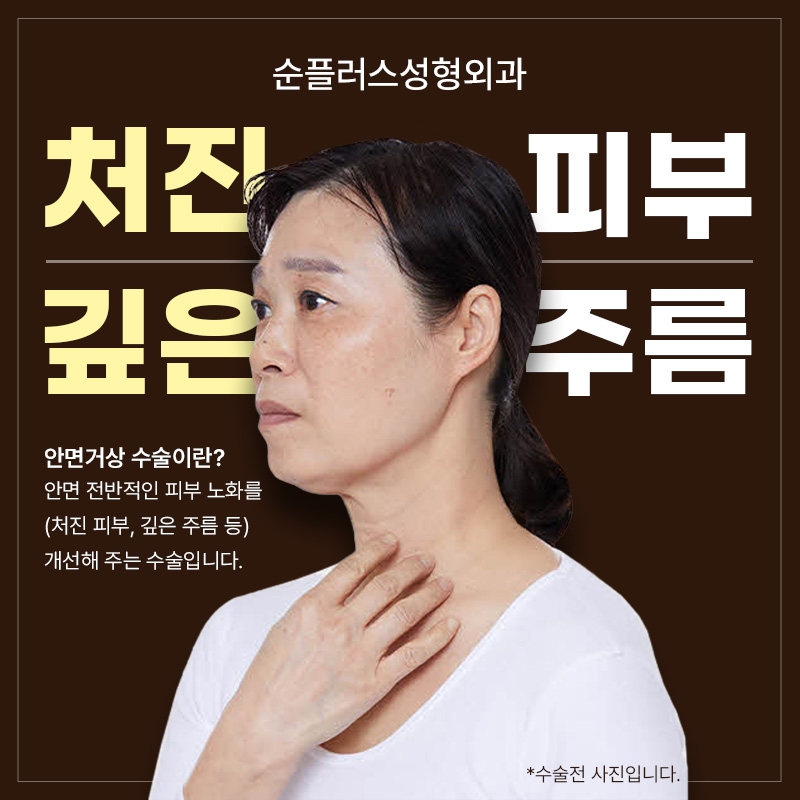 Specialized Facial Lift Clinic _ As skin ages, it needs to be lifted from within to help improve sagging image 2