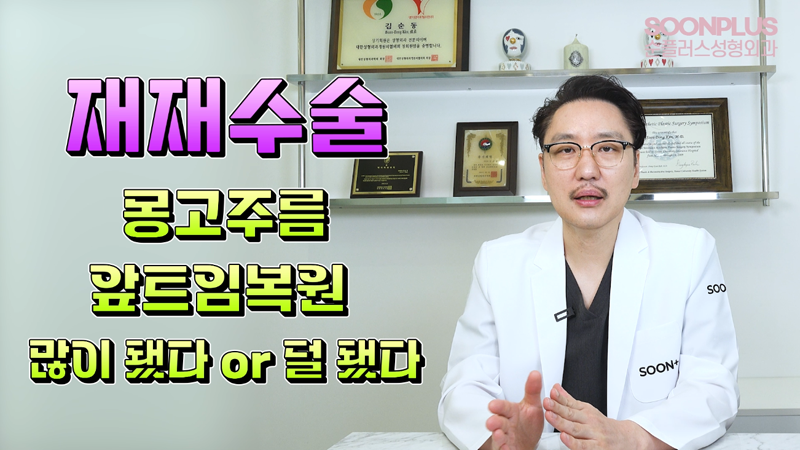 'Am I Really a Candidate for Epicanthoplasty Revision?' Dr. Kim Soondong’s Story About Epicanthoplasty Revision Surgery image 5