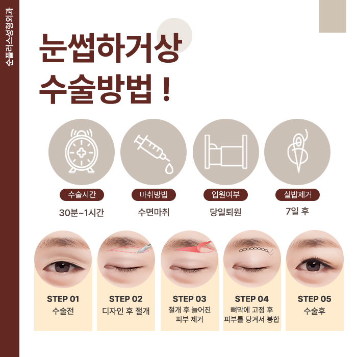 중년 처진 눈꺼풀수술 탄력되찾으며 관련 이미지 4
