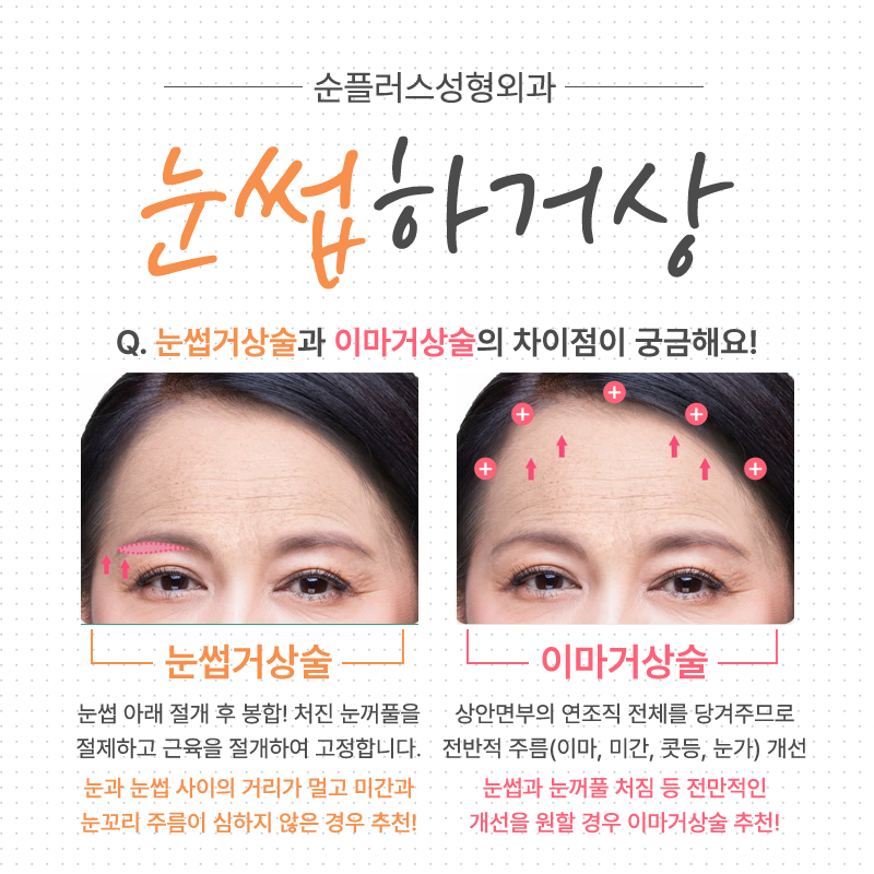 눈꺼풀처짐수술 중년눈꺼풀이 처졌다면 관련 이미지 4