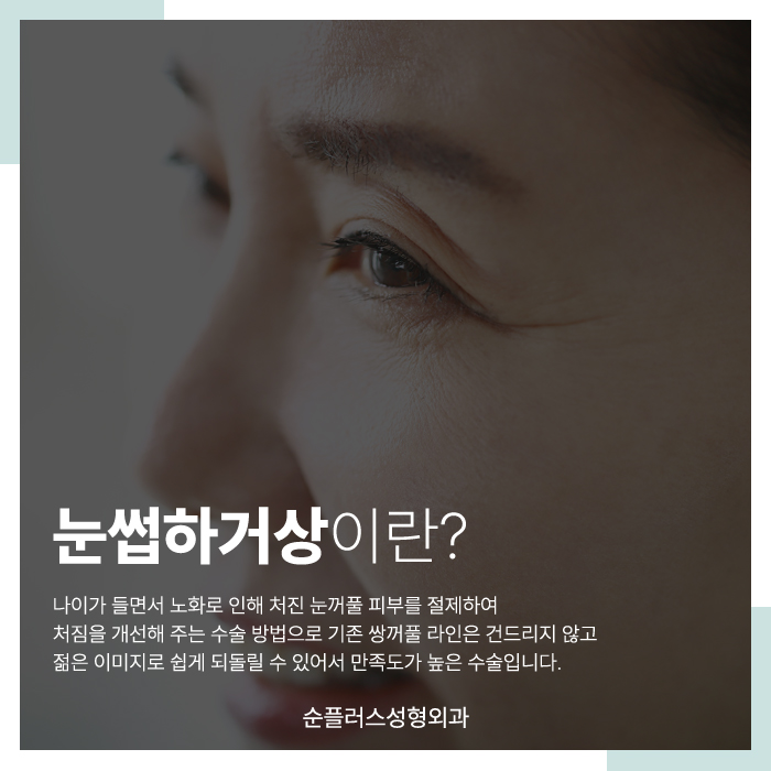 눈썹거상수술 자연스러움을 살리며 관련 이미지 2