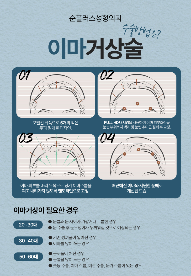What Are the Effects and Procedure of a Forehead Lift, and Who Needs It? image 3