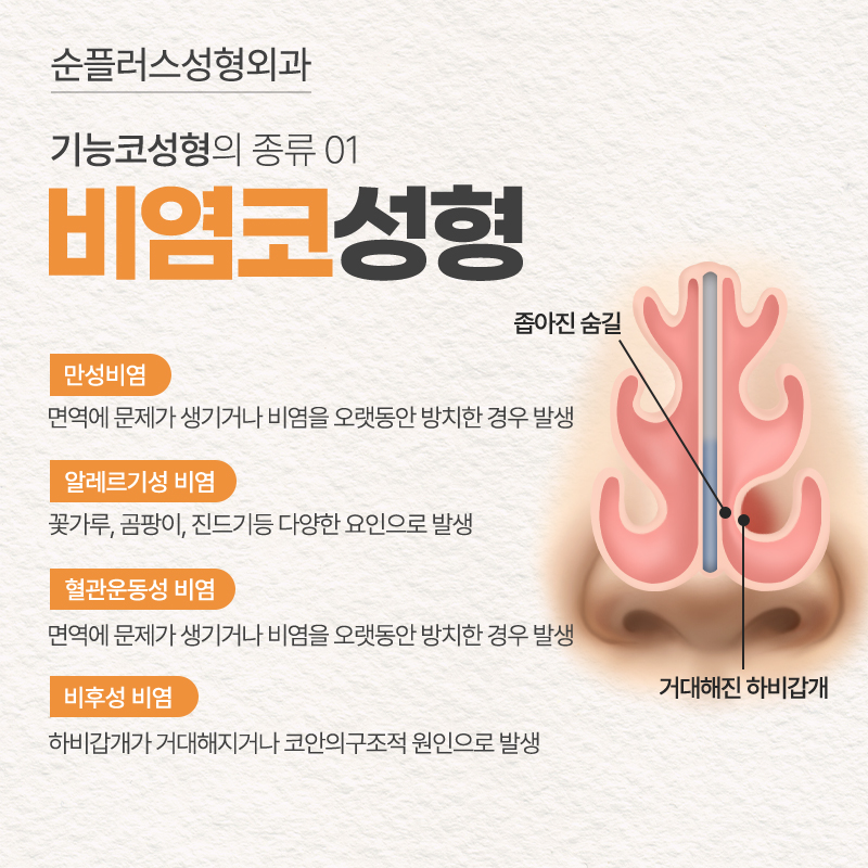 Checking Insurance Coverage for Functional Rhinoplasty, and Confirming Both Aesthetic and Functional Improvement image 3