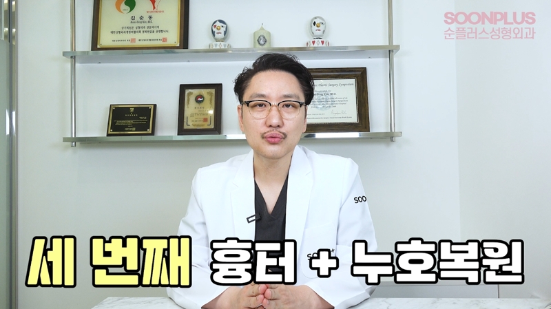 'Am I Really a Candidate for Epicanthoplasty Revision?' Dr. Kim Soondong’s Story About Epicanthoplasty Revision Surgery image 4
