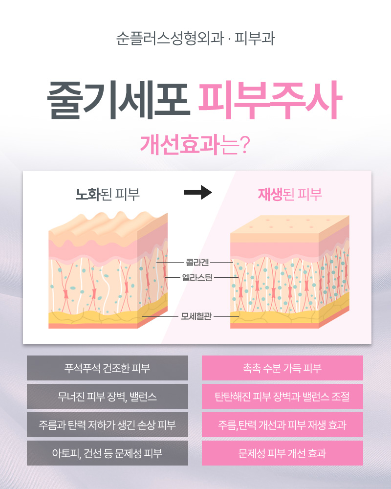 줄기세포피부주사, 어떤 효과들이 있고 유지기간은 얼마나? 관련 이미지 3