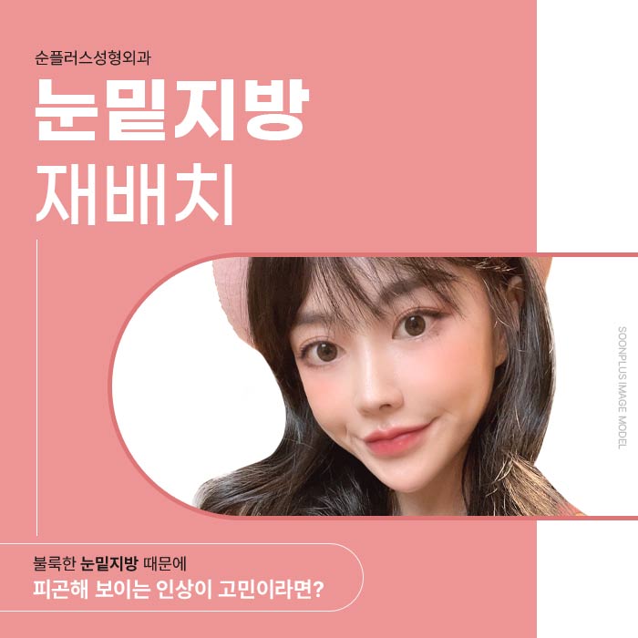 눈밑지방재배치수술 비용과 과정도 꼼꼼하게 관련 이미지 1