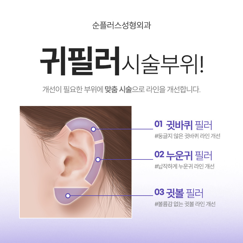 Ear filler effects that enhance the three-dimensional look of the face, management, duration, and precautions image 4