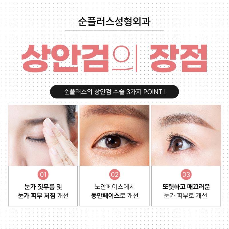 처진눈수술 자연스럽게 또렷해지는 눈매 관련 이미지 4