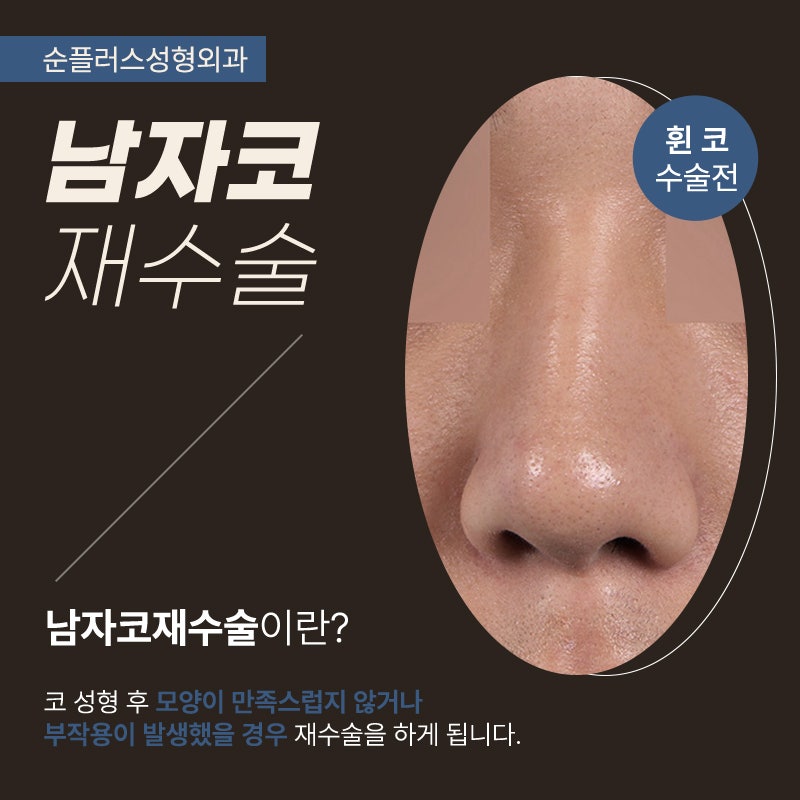 남자코성형잘하는곳 옆모습이 매력적으로 관련 이미지 2