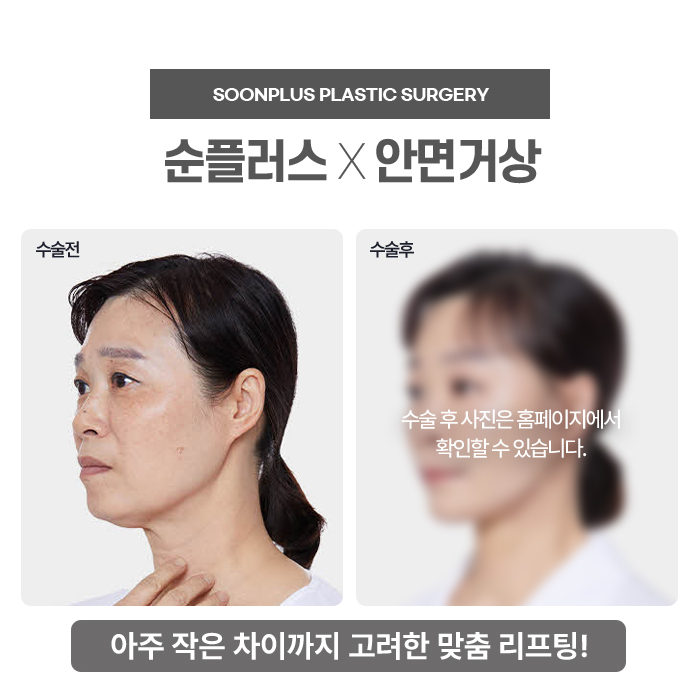 An anti-aging specialty hospital, Sinsa Station Soon Plus Plastic Surgery and Dermatology. image 2