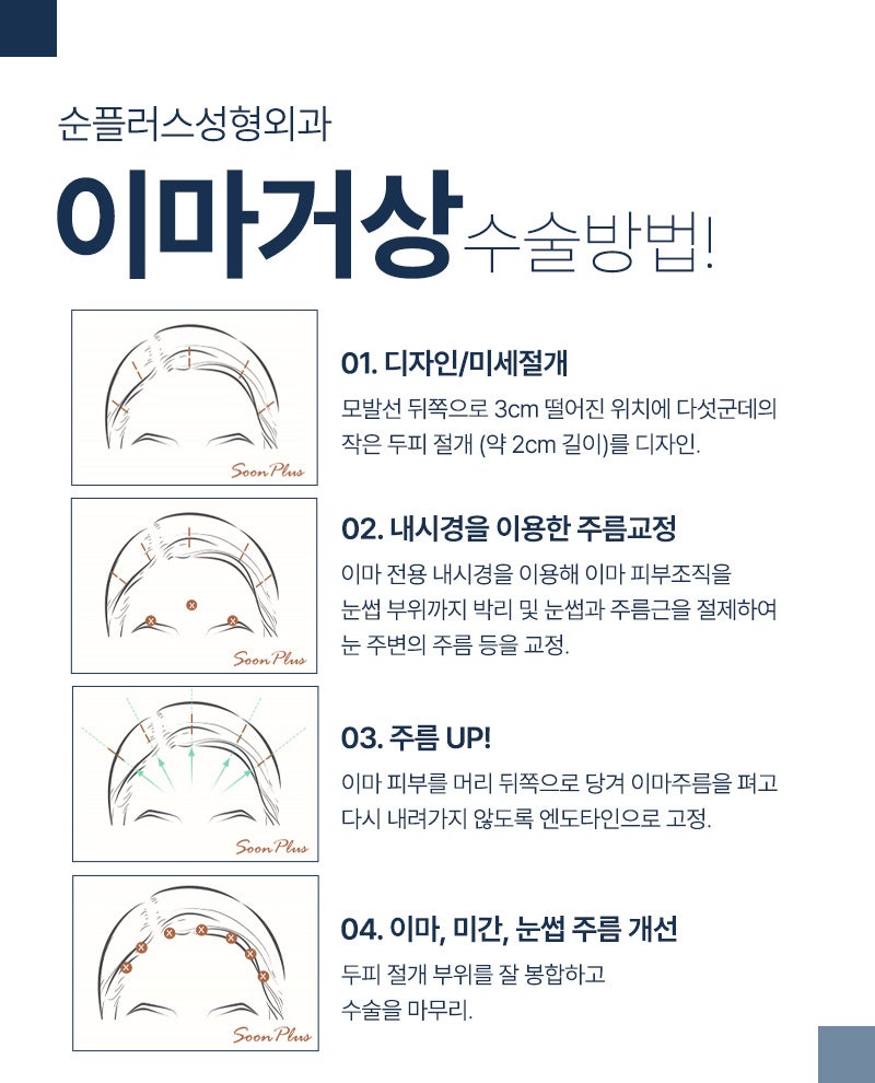 Will the forehead become wider after forehead lift surgery? How is it fixed? image 4