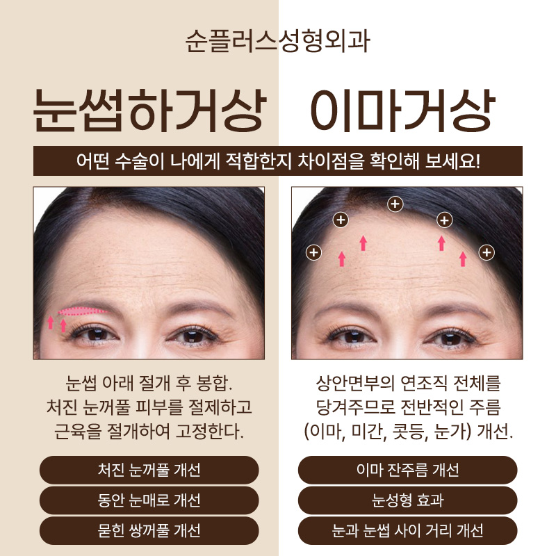 처진눈 자연스럽게 개선하기 위해 눈썹하거상 관련 이미지 3
