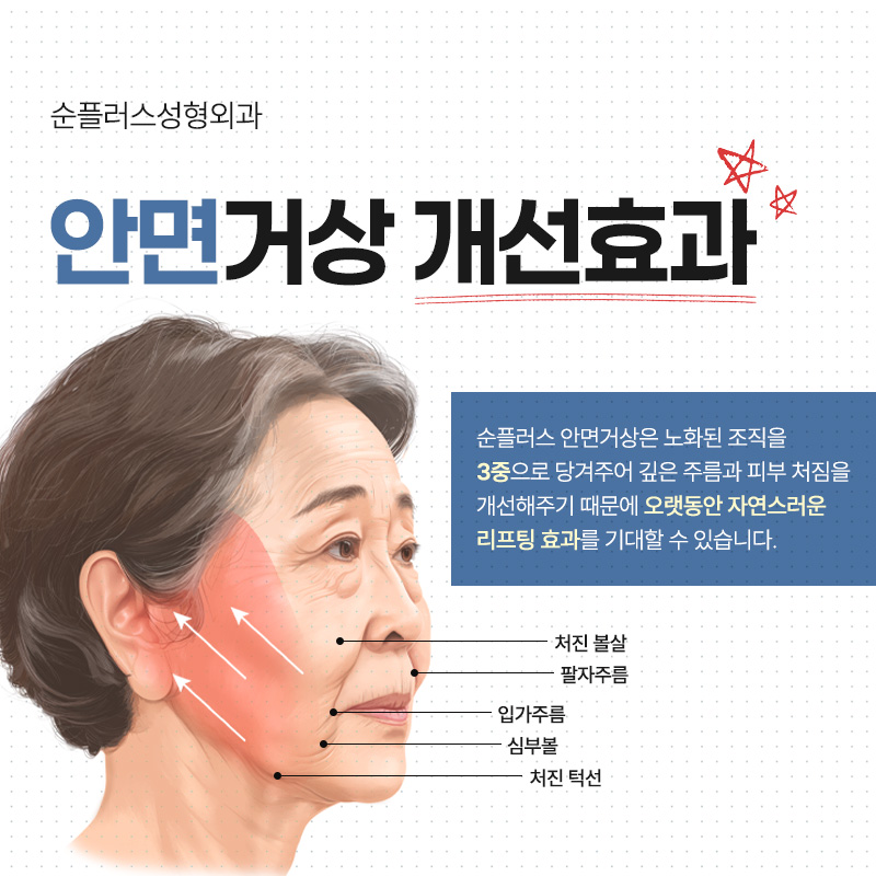 Can a facelift achieve the Brad Pitt youthful effect? image 3