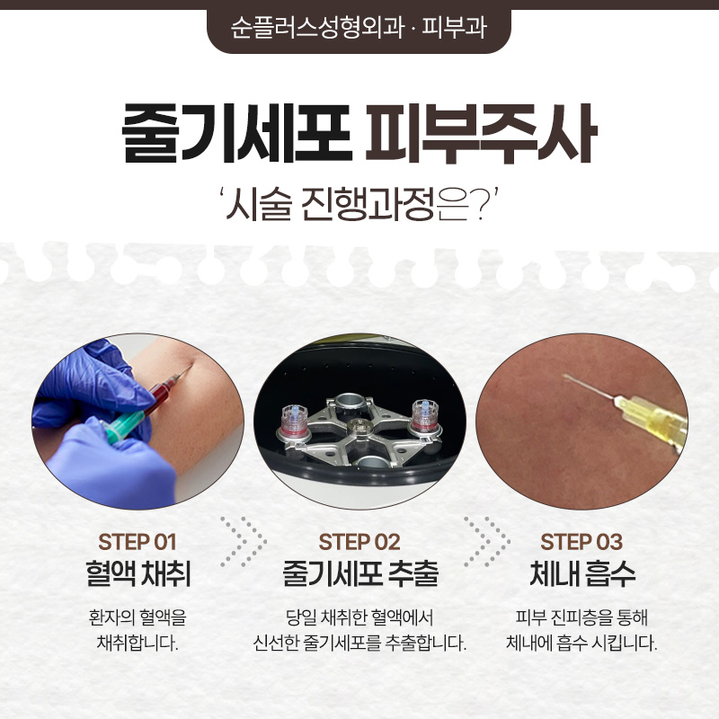 줄기세포 피부주사, 신중한 병원선택을 위해 관련 이미지 4