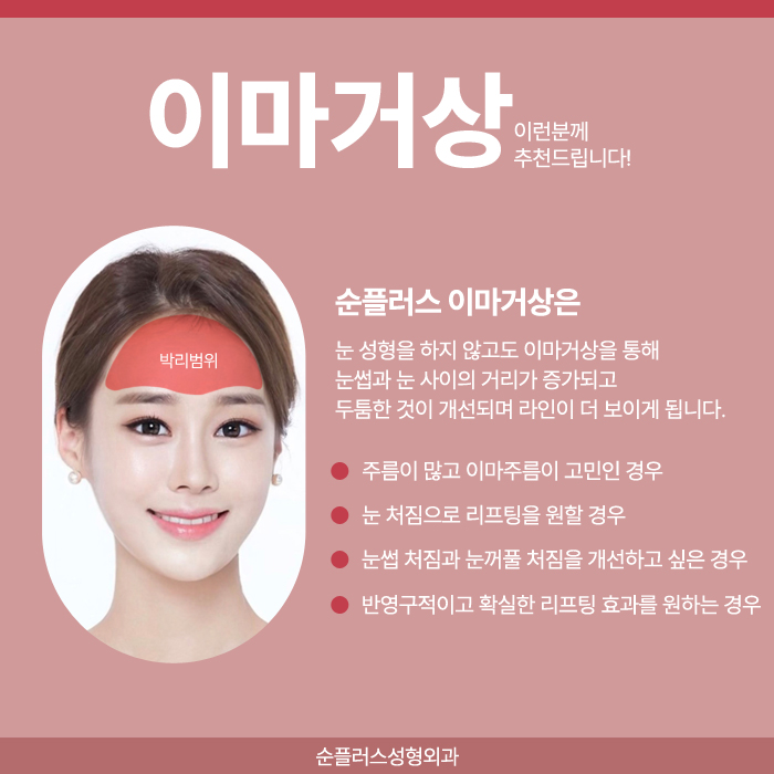 이마주름수술 자연스러운 개선방안을 위해 관련 이미지 3