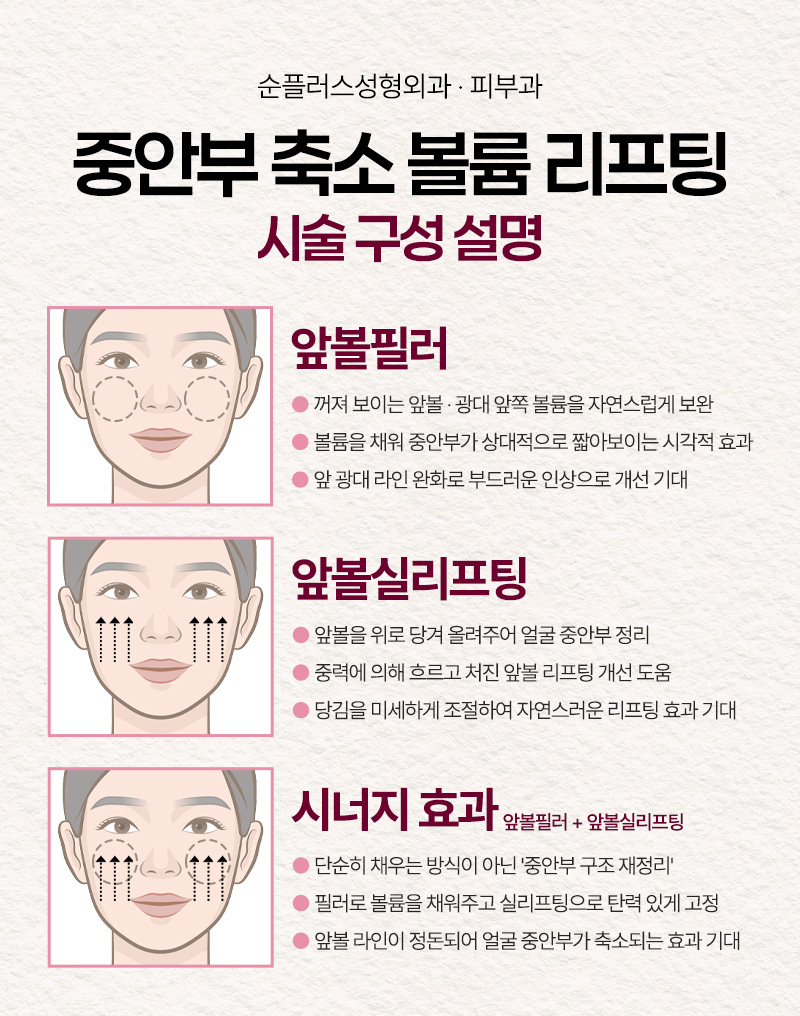 Mid-Face Reduction Volume Lifting for a Younger-Looking Effect by Shortening the Mid-Face Length image 3