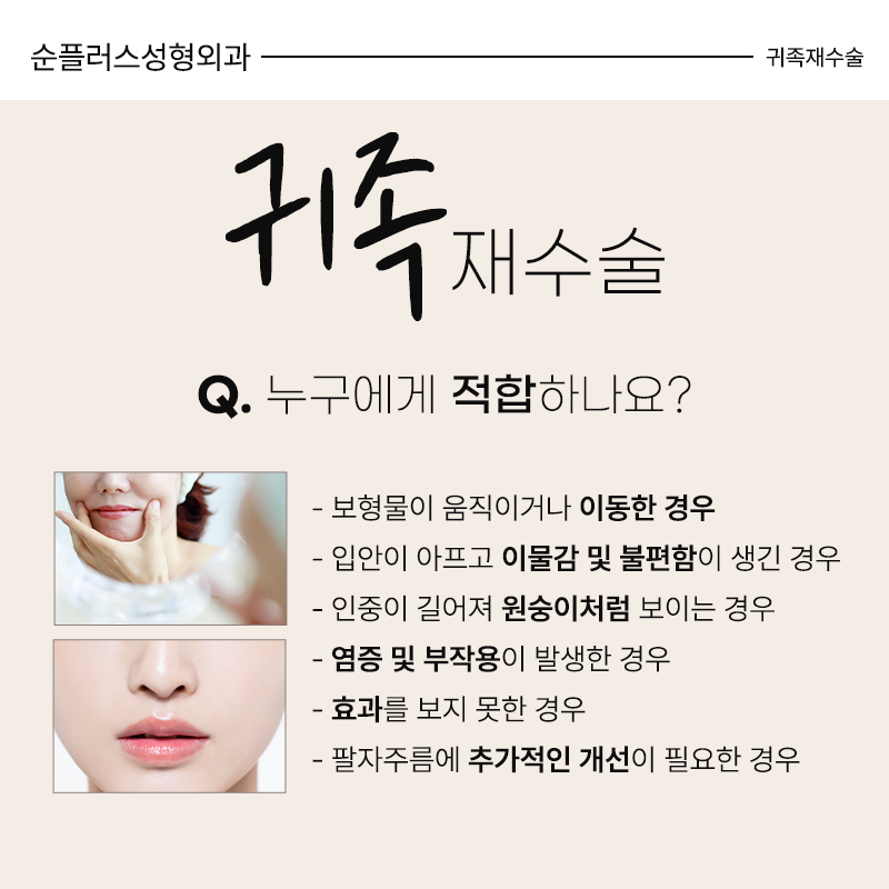귀족재수술 올바른 위치선정으로 관련 이미지 3