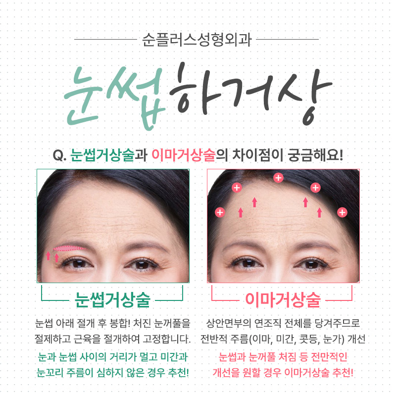 [눈썹거상수술] 눈과 눈썹 거리가 먼 경우, 눈꺼풀이 처졌을때 관련 이미지 5