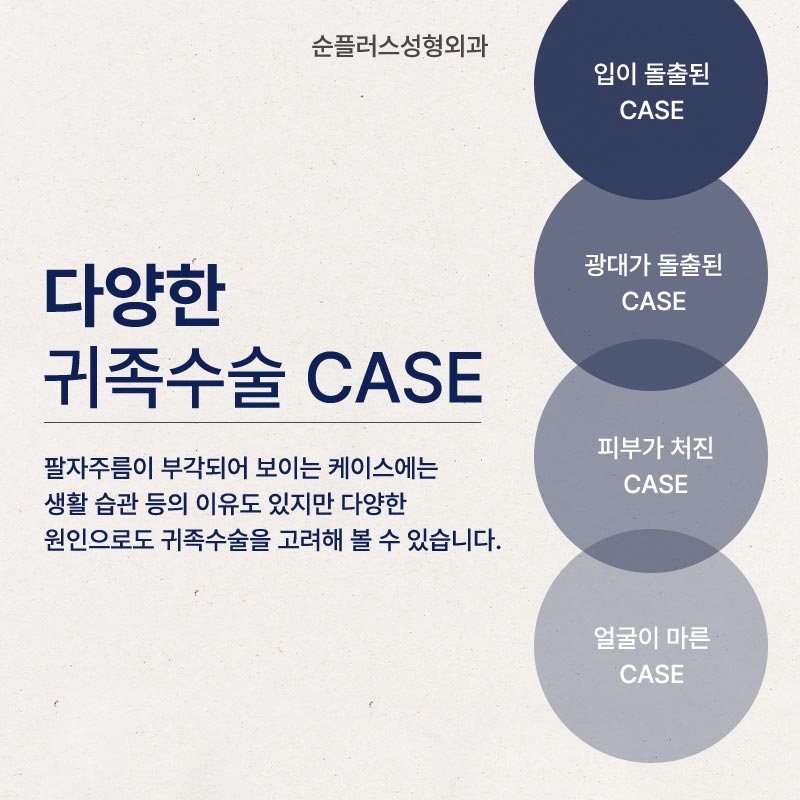 나이들어 보이는 팔자꺼짐, 개선방안은 관련 이미지 3