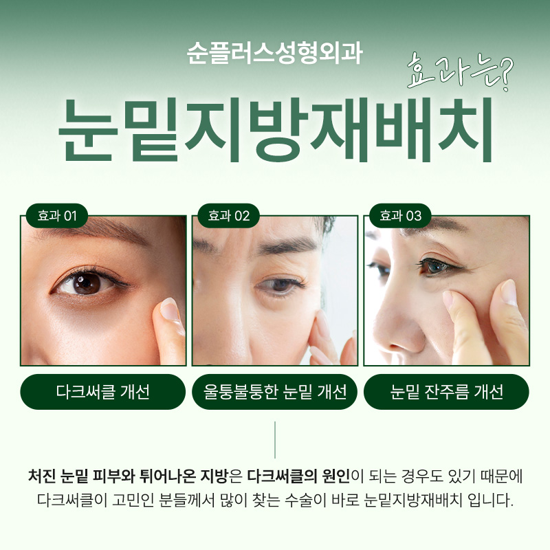 Gangnam Under-Eye Fat Repositioning Plastic Surgery Removes Protruding Fat image 3