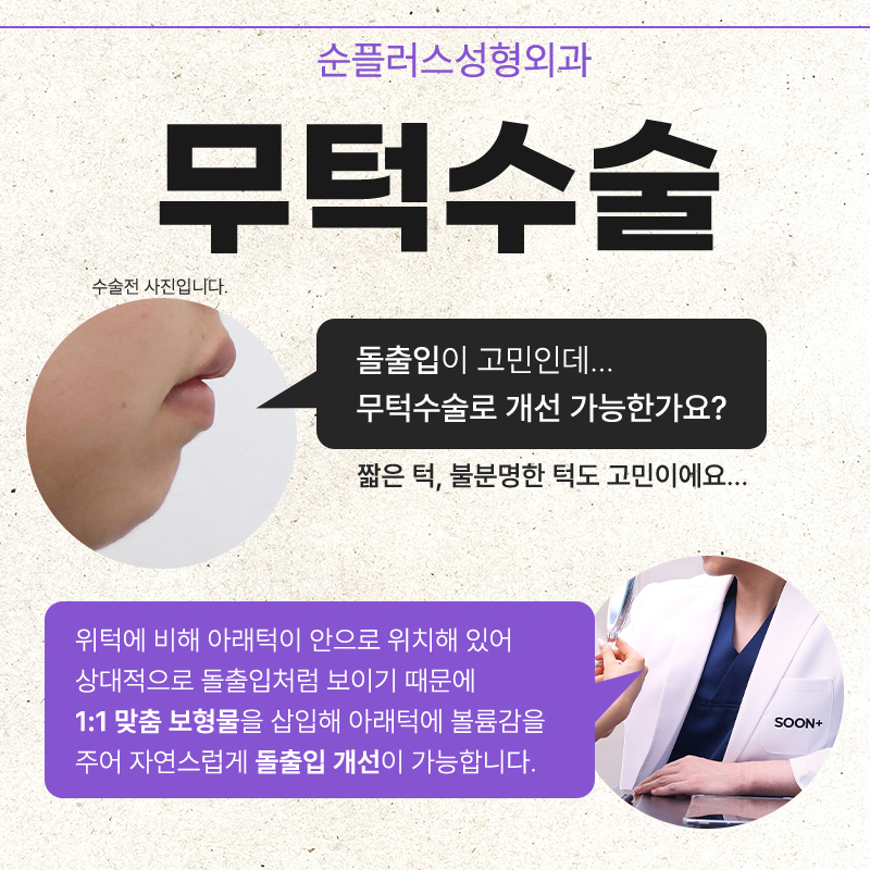 If you’re worried about chin implant movement image 2