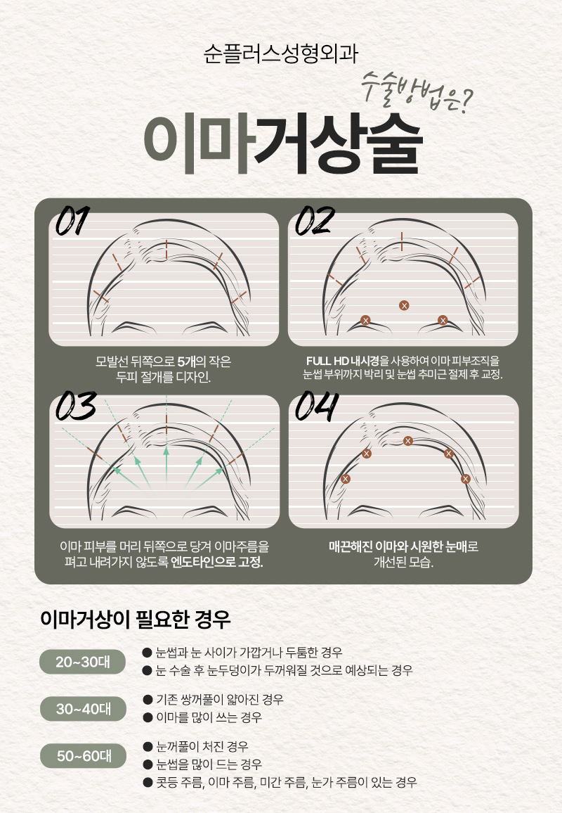 Is Endotine Fixation Forehead Lifting Different? [Soonplus Director Lim Jong-min] image 3