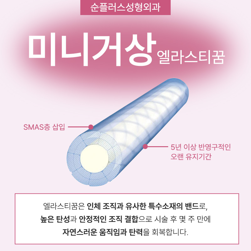 미니안면거상술 심하게 늘어지기 전에 관련 이미지 4