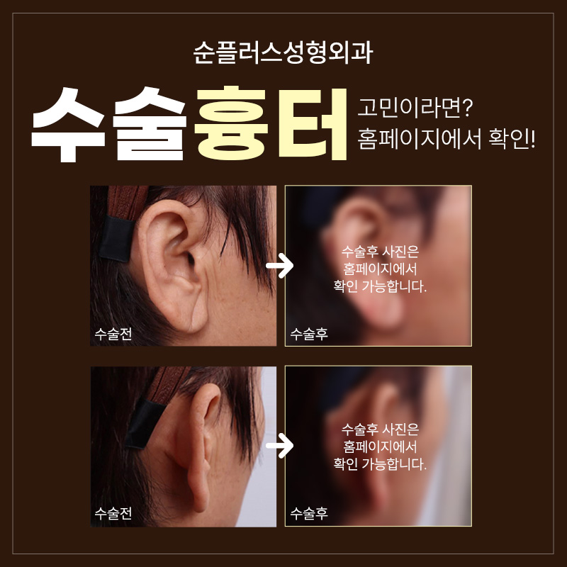 Specialized Facial Lift Clinic _ As skin ages, it needs to be lifted from within to help improve sagging image 6