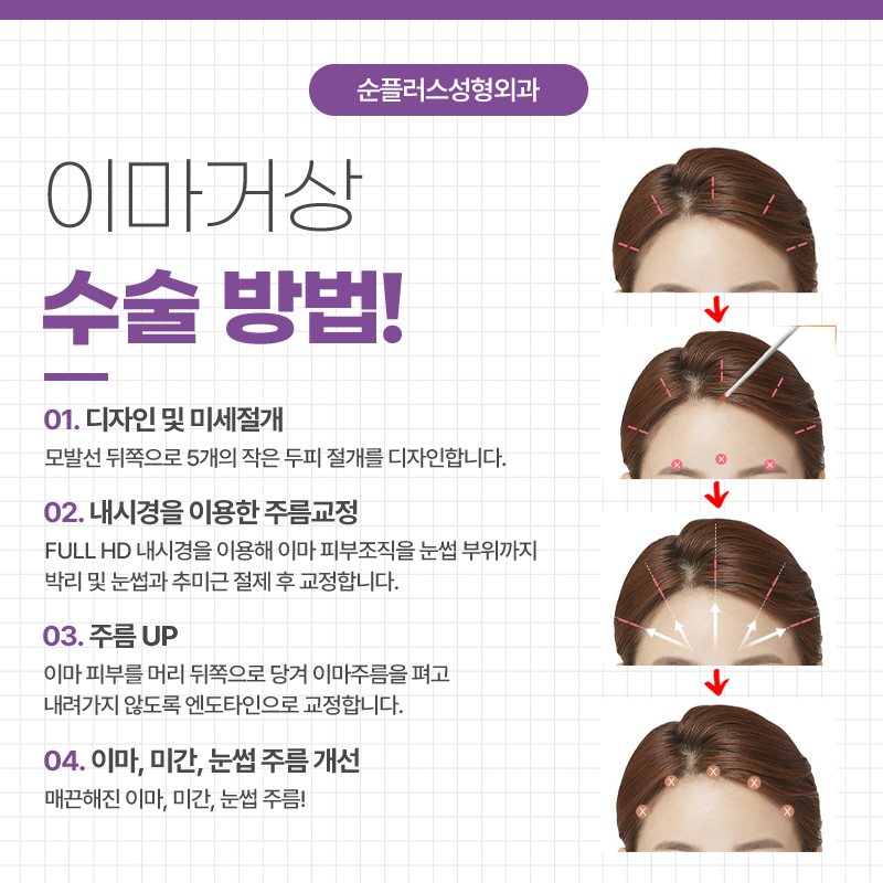 이마거상술 효과 유지를 높이기 위해 관련 이미지 4