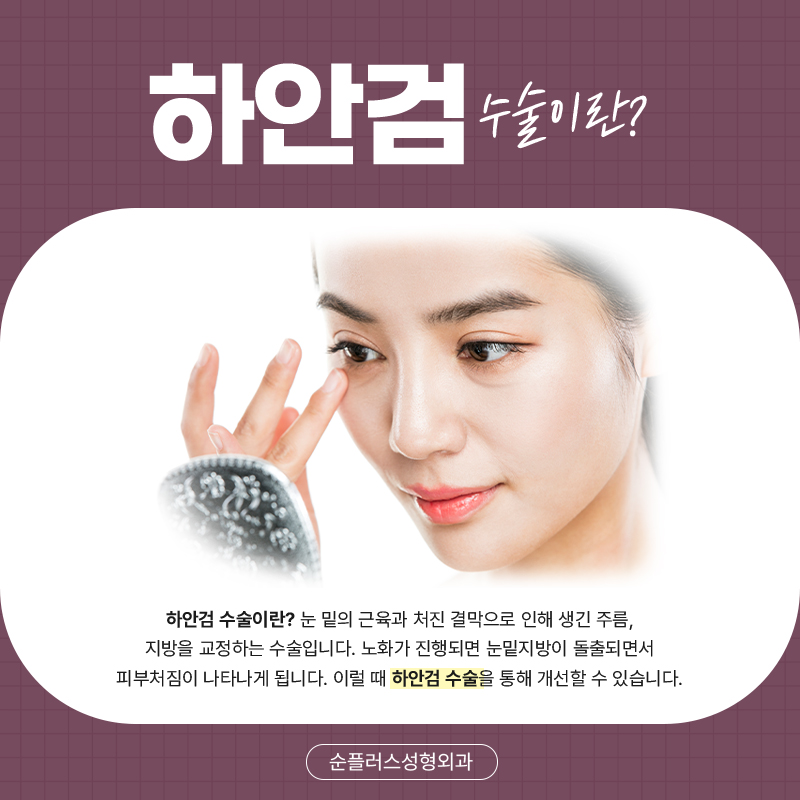 하안검수술잘하는곳 불룩한 눈아래 관련 이미지 2
