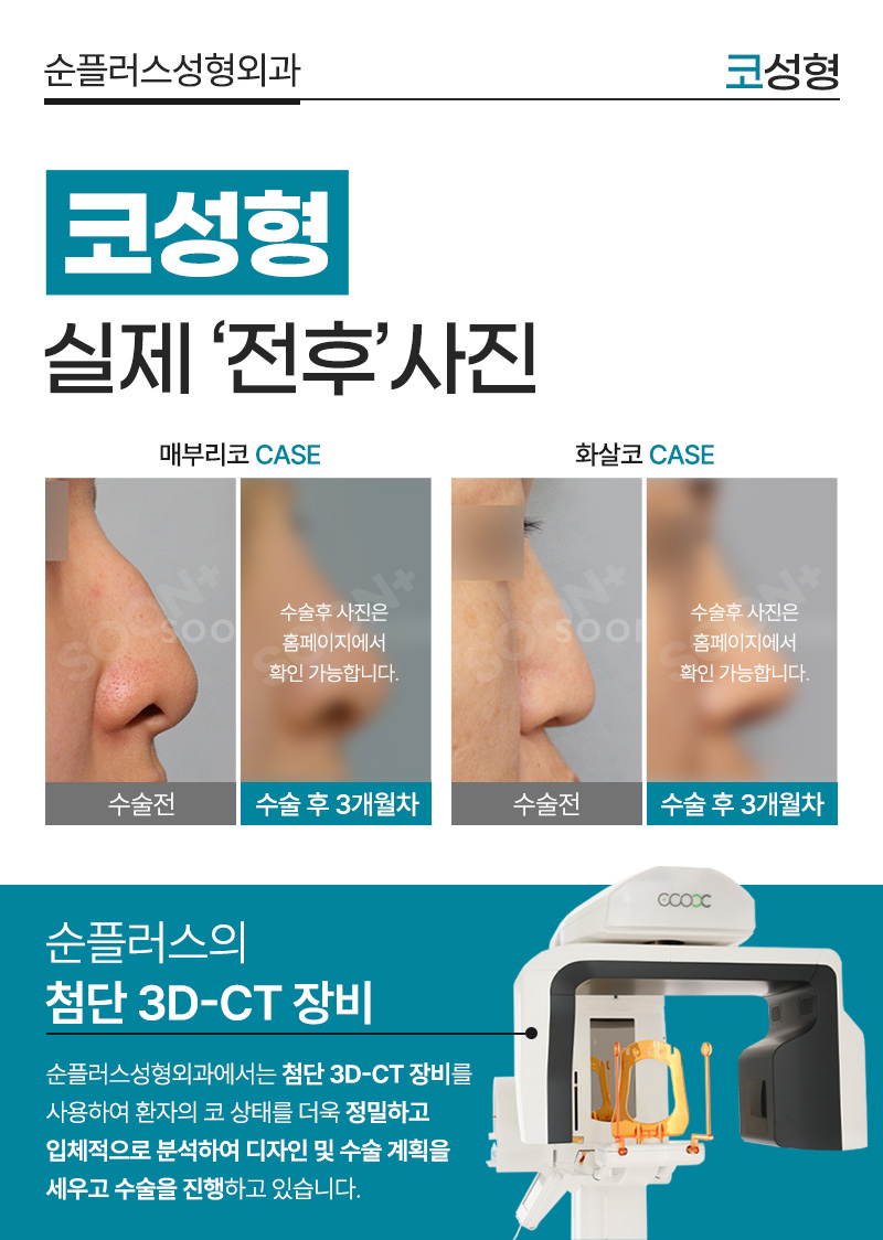 Looking at Balance and Proportion at a Nose Plastic Surgery Clinic near Sinsa Station image 4