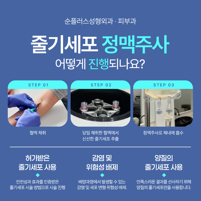 줄기세포 정맥주사로 기대할 수 있는 효과. 관련 이미지 3