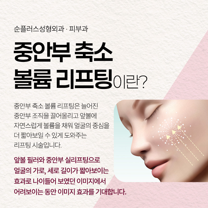 Mid-Face Reduction Volume Lifting for a Younger-Looking Effect by Shortening the Mid-Face Length image 2
