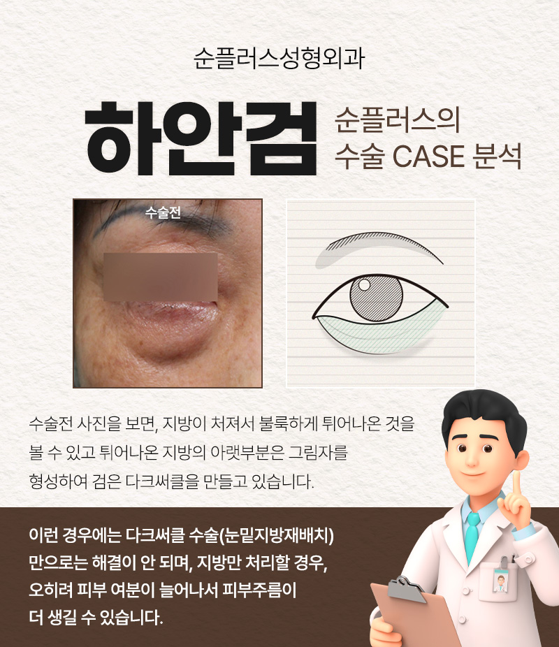 눈밑 하안검수술 회복기간 흉터도 찾아봐야 관련 이미지 3