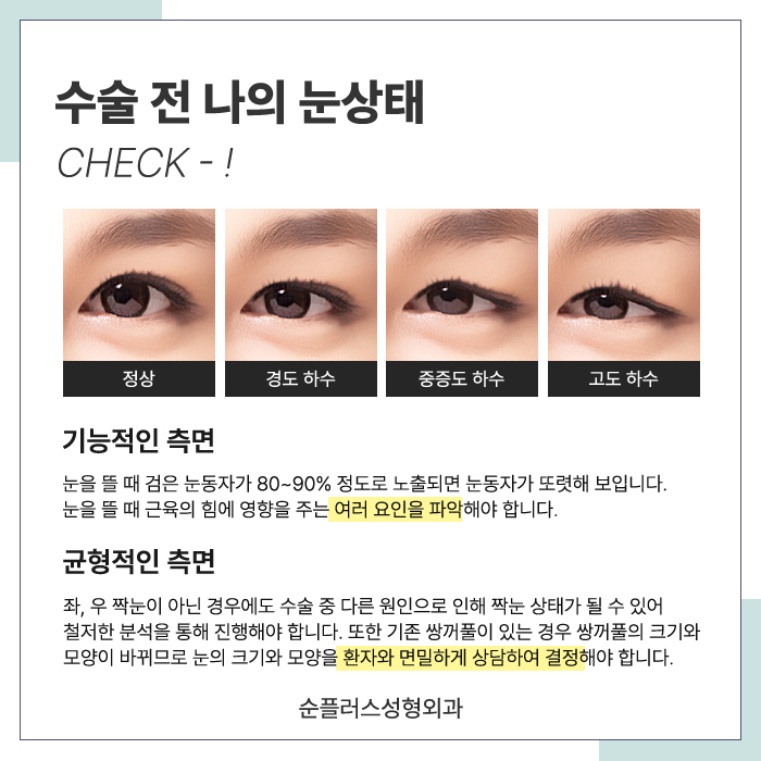 눈썹거상수술 자연스러움을 살리며 관련 이미지 5