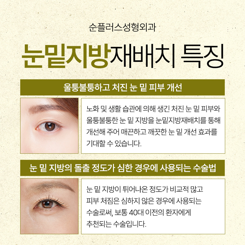 눈밑지방재배치 수술로 칙칙한 다크써클 개선할 수 있나요? 관련 이미지 5
