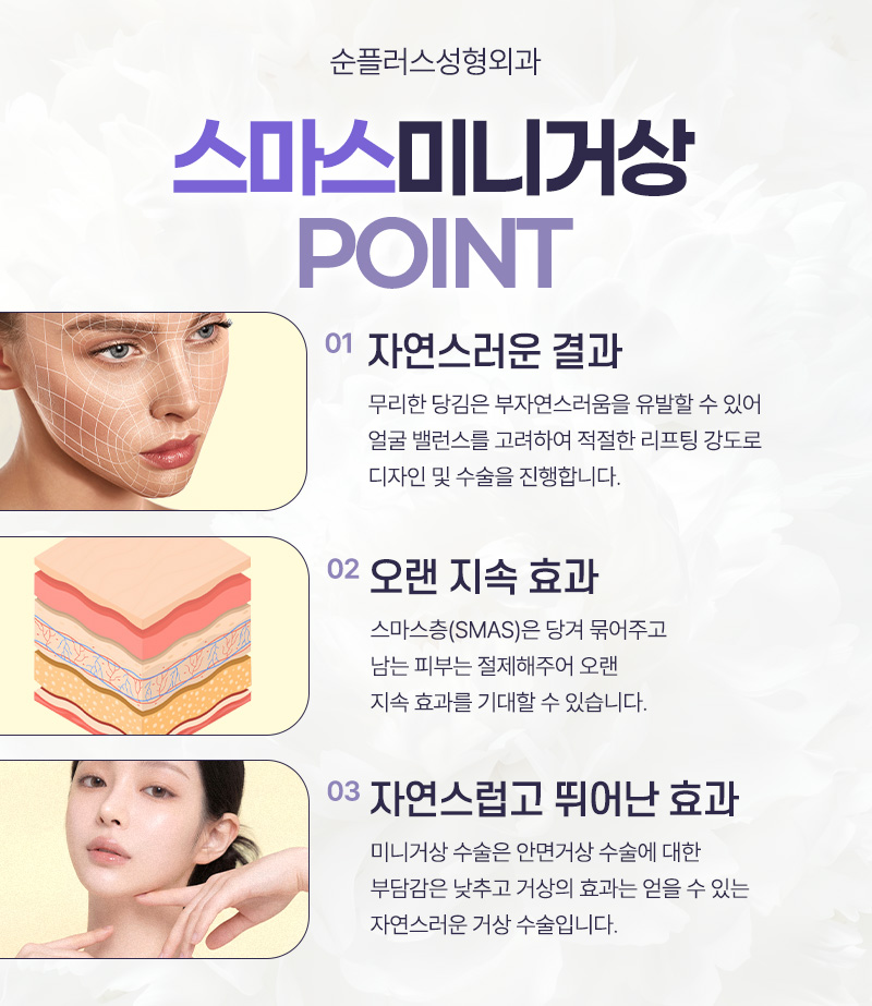 스마스미니거상 처짐의 원인을 찾아 관련 이미지 6