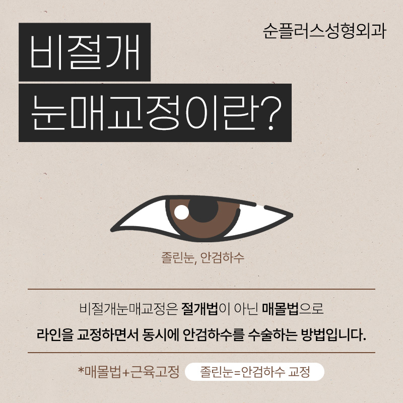 비절개눈매교정 전후 후기 다양한 케이스 확인하며 관련 이미지 2