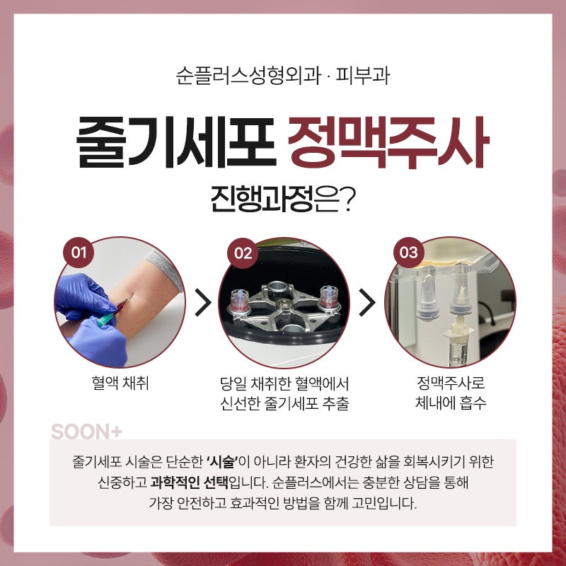 Stem Cell Intravenous Injection: Diverse Anti-Aging Effects by Activating the Body’s Natural Healing Power image 5
